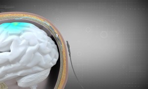 国内首款侵入式脑机接口获批上市，数百万脊髓损伤患者有望受益